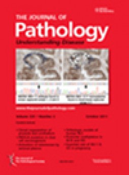 Journal Of Pathology杂志